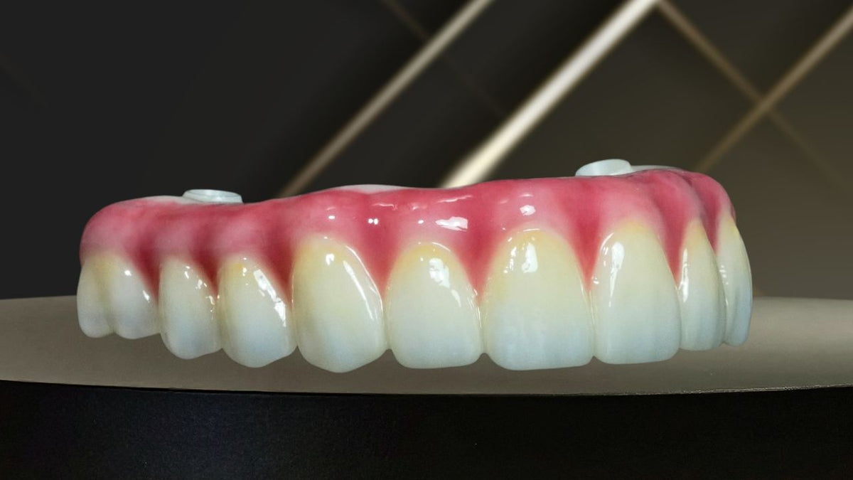 How This Dental Lab Transformed Their All-On-X Process