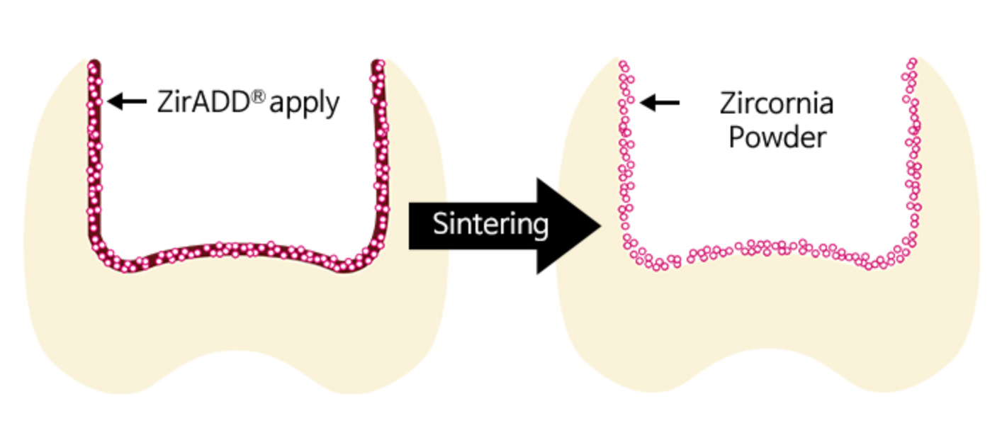 ZirADD (zirconia etch)